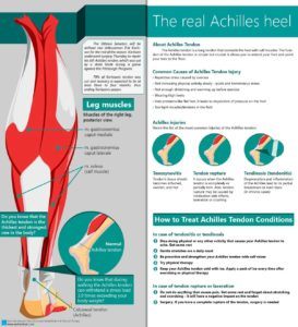 Achilles Tendonitis Heel Injury Infographic