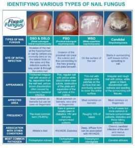 Toe Nail Fungus Types Infographic