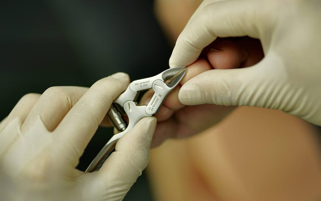 What Surgeries Do Podiatrists Perform?