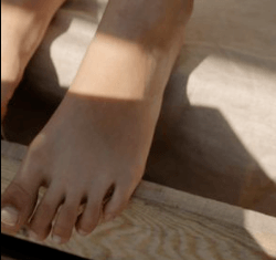 how does diabetic neuropathy affect your feet